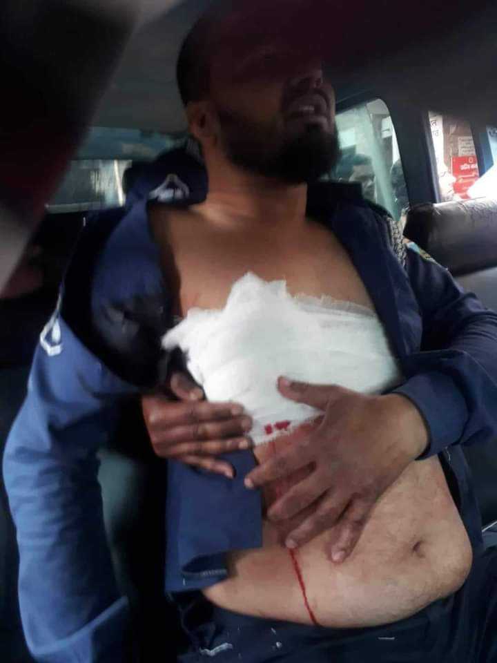 দুর্গাপুরে পোশাক পরা অবস্থায় পুলিশ কে প্রকাশ্যে ছুরি মারলো যুবক