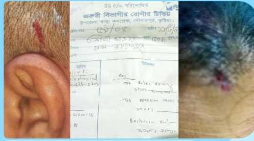 দৌলতপুরে পূর্ব শত্রুতার জেরে সাংবাদিকের ওপর হামলা, আহত ৪