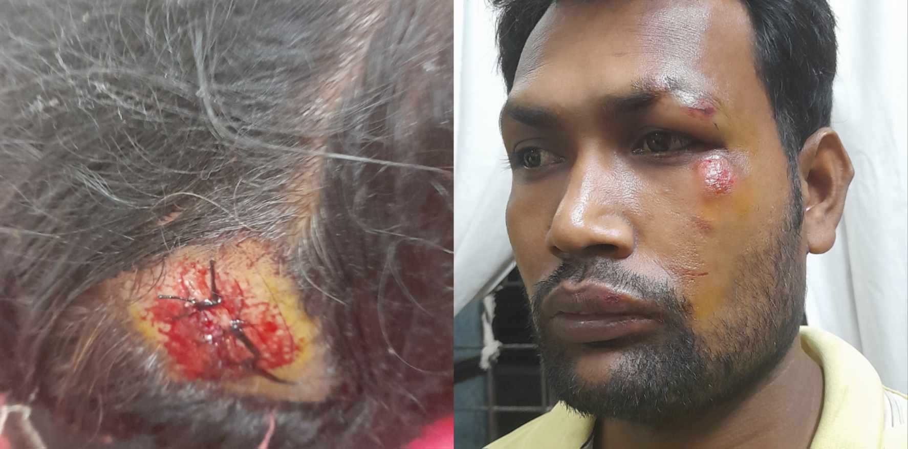 ঈশ্বরদীতে তুচ্ছ ঘটনাকে কেন্দ্র করে মা-ছেলেকে পিটিয়ে জখম