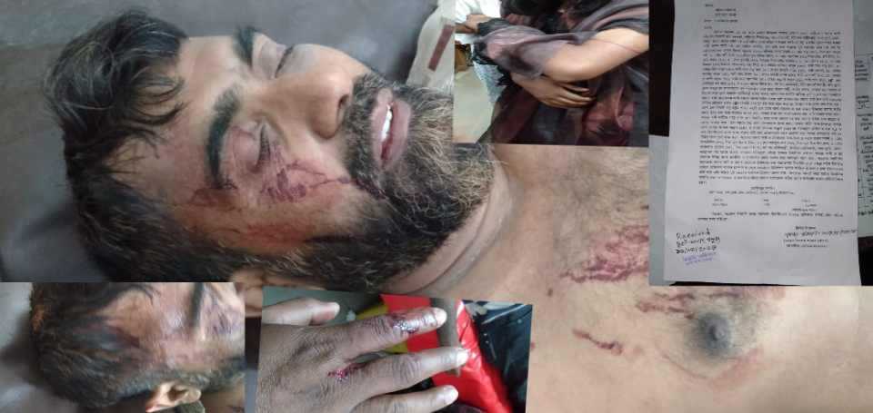 ধুনটে কৃষি কর্মকর্তাকে মারপিট -থানায় অভিযোগ 