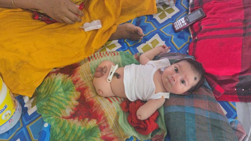 পিরোজপুরে হাত-পাবিহীন শিশুর জন্ম: বাবা বললেন ফেলে দিতে