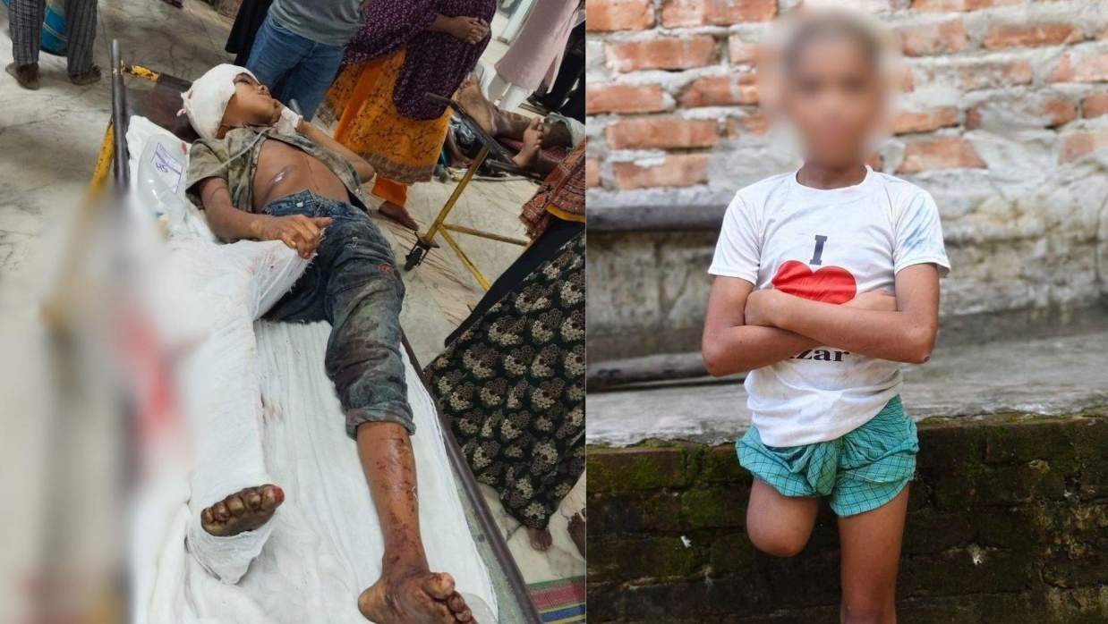 ট্রেন দুর্ঘটনার কারণে পা কাটতে হয়েছিল সেই শিশুর, বেরিয়ে এলো চাঞ্চল্যকর তথ্য