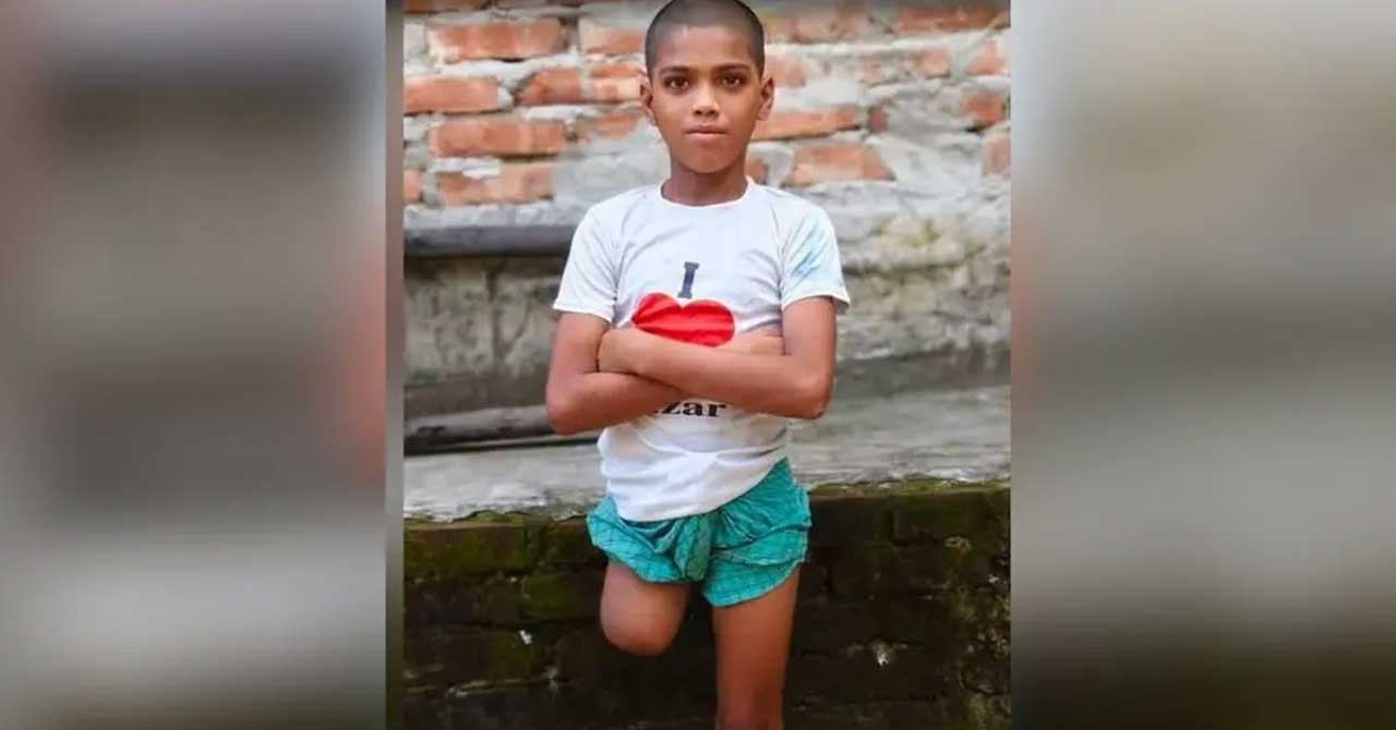 চুল কাটতে বের হওয়া রায়হান ফিরল এক পা ও কিডনি হারিয়ে