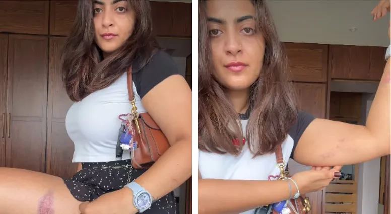 পুলিশি হেনস্তার অভিযোগ এনে সরব আমিরের ভাইঝি